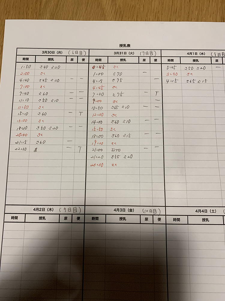 口唇口蓋裂の搾乳表